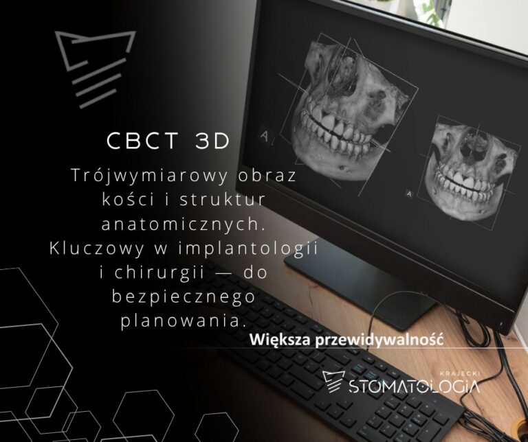 Diagnostyka obrazowa: RTG punktowe