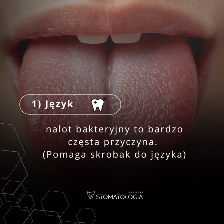 Nieświeży oddech rzadko bierze się „znikąd” — zwykle to sygnał z jamy ustnej.