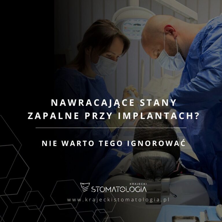 Nawracające stany zapalne przy implantach? Nie warto tego ignorować
