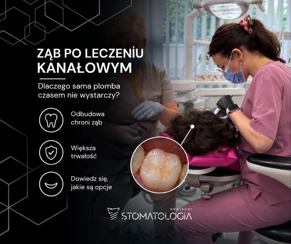 Ząb po leczeniu kanałowym – co dalej